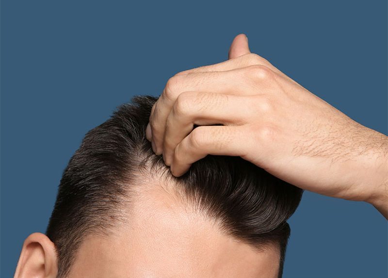 hair loss treatment in Chicago, IL