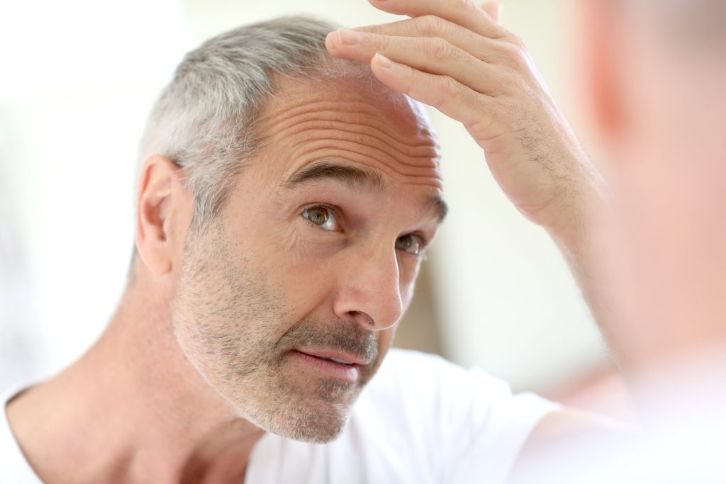 Is a Hair Transplant Right for You? Factors to Consider 
