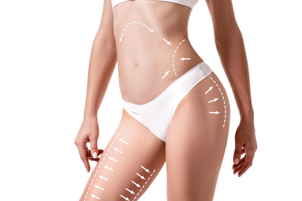 Targeted Liposuction: Precision Sculpting for Your Dream Body