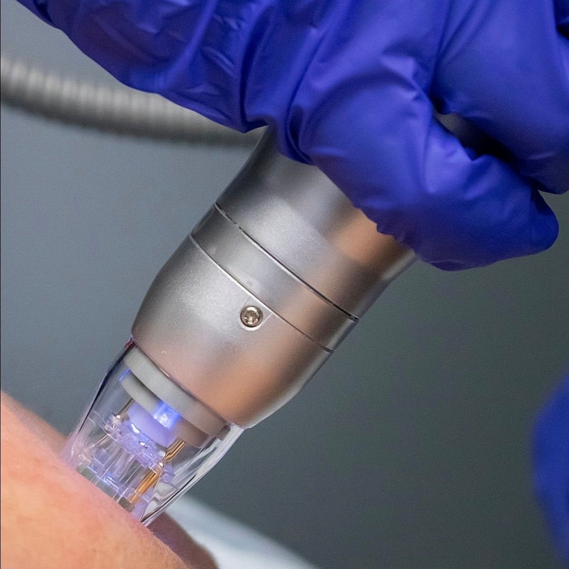 Aesthetic Medicine in Chicago, IL