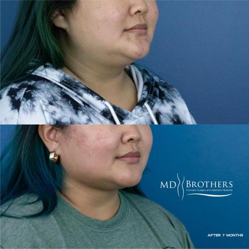 MD-Brothers_4new