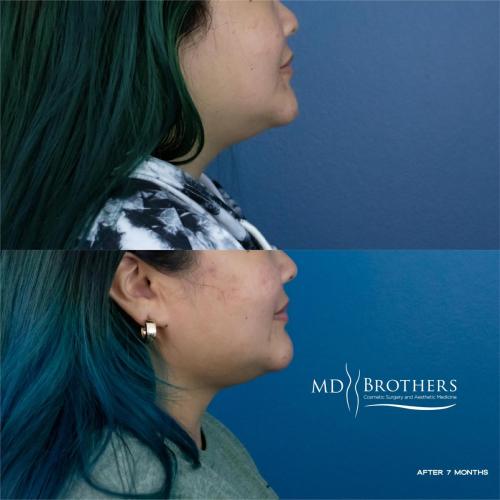 MD-Brothers_5new